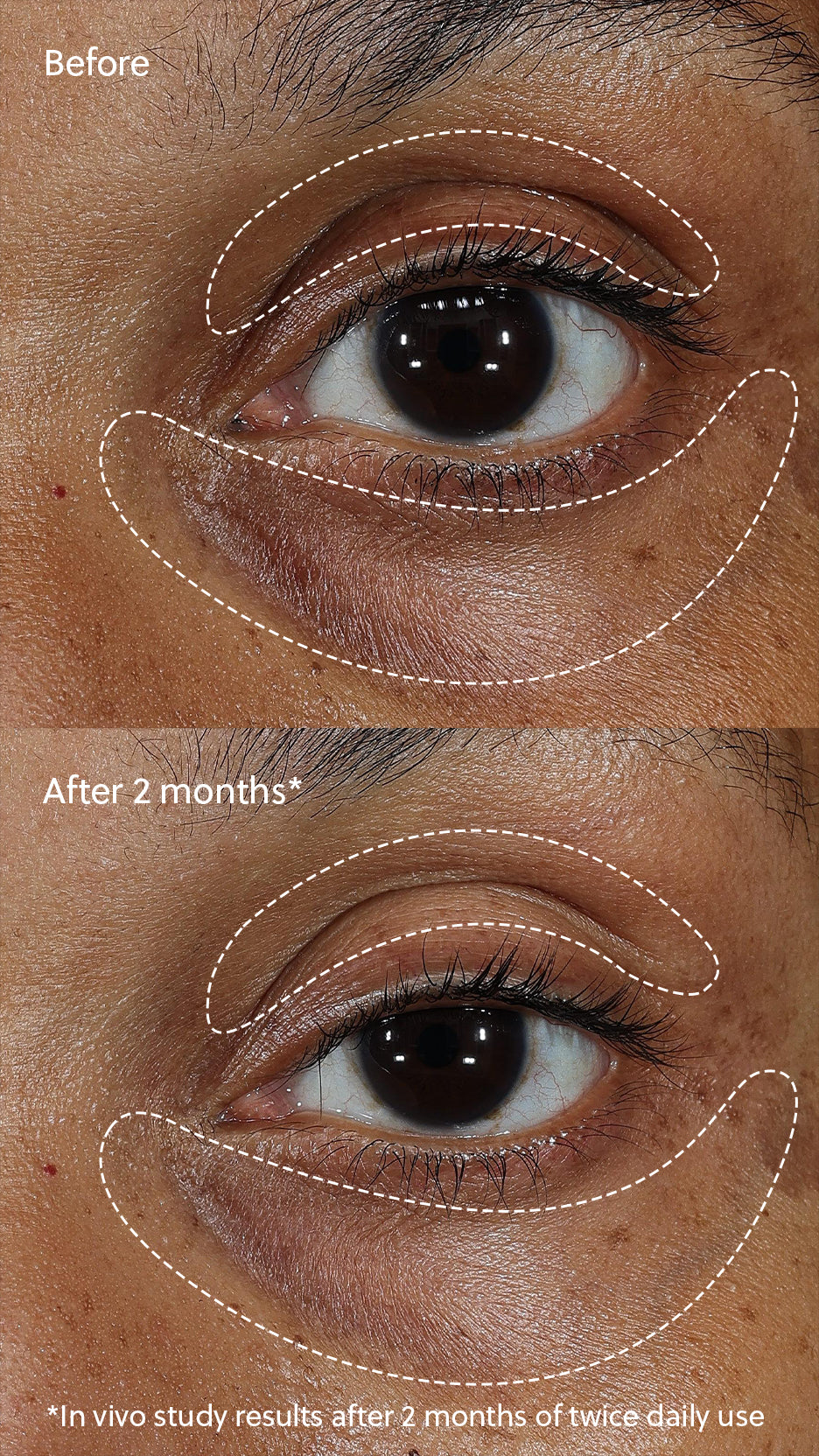 Eminence - C+ Eye Cream